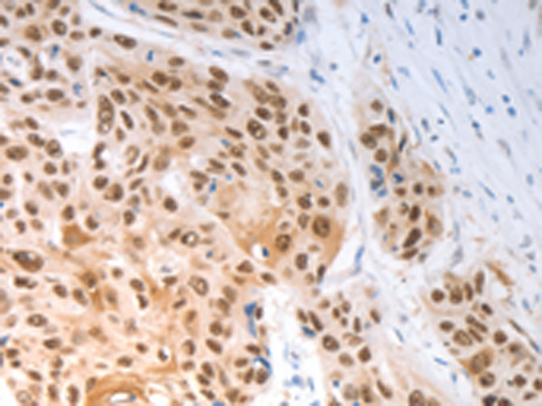 Rabbit Polyclonal Antibody to SLC22A8