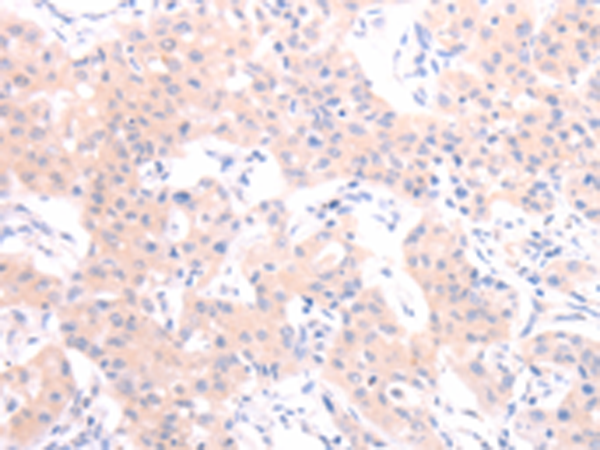 Rabbit Polyclonal Antibody to HCRT/pan Orexin
