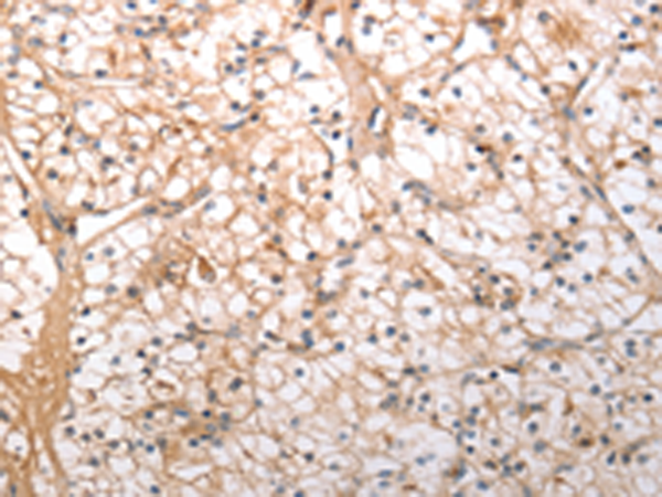 Rabbit Polyclonal Antibody to HCRTR1