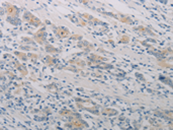 Rabbit Polyclonal Antibody to PTAFR