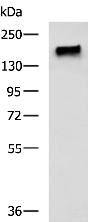 Rabbit Polyclonal Antibody to PALB2