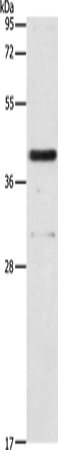 Rabbit Polyclonal Antibody to PAFAH2