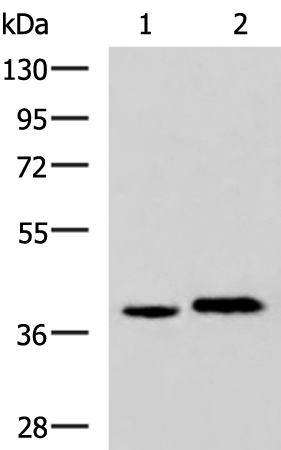Rabbit Polyclonal Antibody to PLPPR5