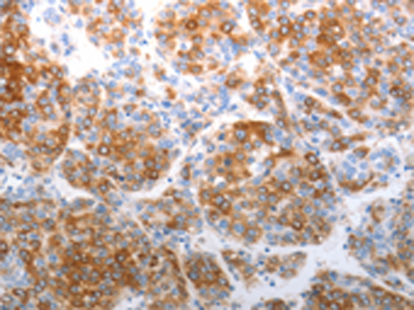 Rabbit Polyclonal Antibody to CDH5