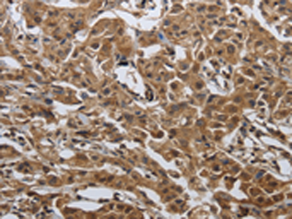 Rabbit Polyclonal Antibody to PDCD7