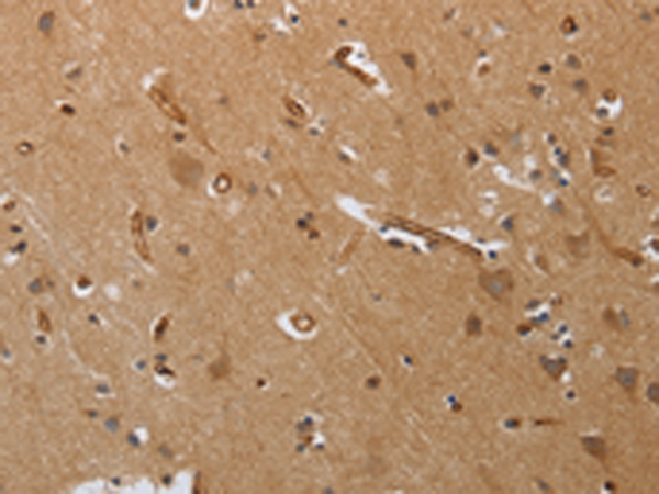 Rabbit Polyclonal Antibody to PODXL