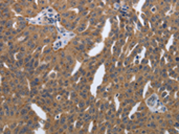 Rabbit Polyclonal Antibody to PDGFA