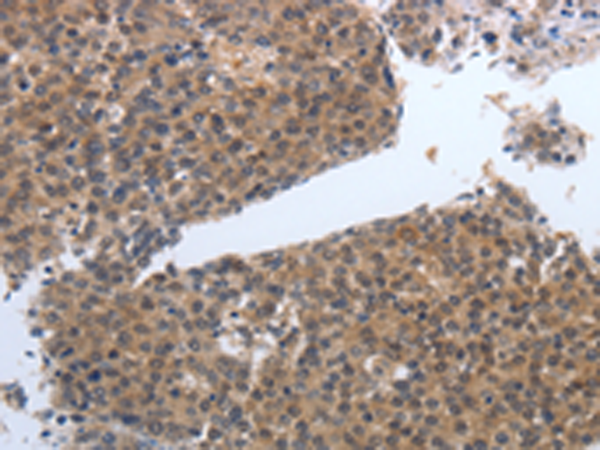 Rabbit Polyclonal Antibody to PDGFB