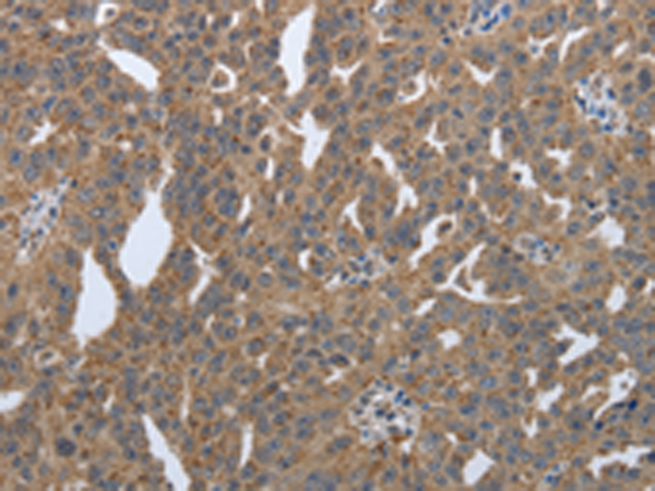 Rabbit Polyclonal Antibody to PDIA2