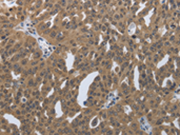 Rabbit Polyclonal Antibody to PRKAR1B