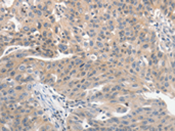 Rabbit Polyclonal Antibody to PRKD1