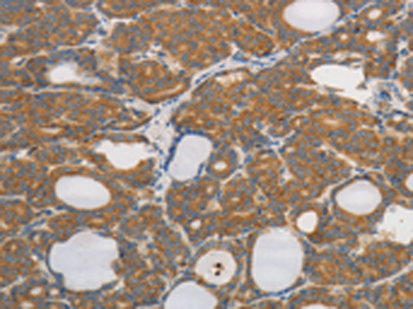 Rabbit Polyclonal Antibody to PPP2CB