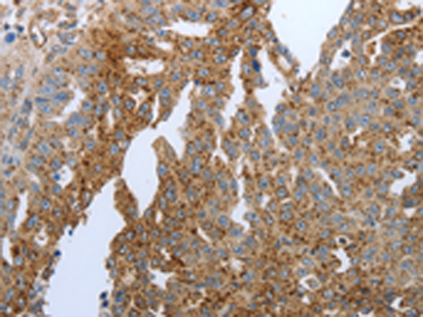Rabbit Polyclonal Antibody to PPARG
