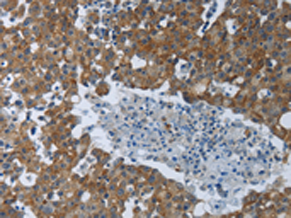 Rabbit Polyclonal Antibody to EIF2AK2
