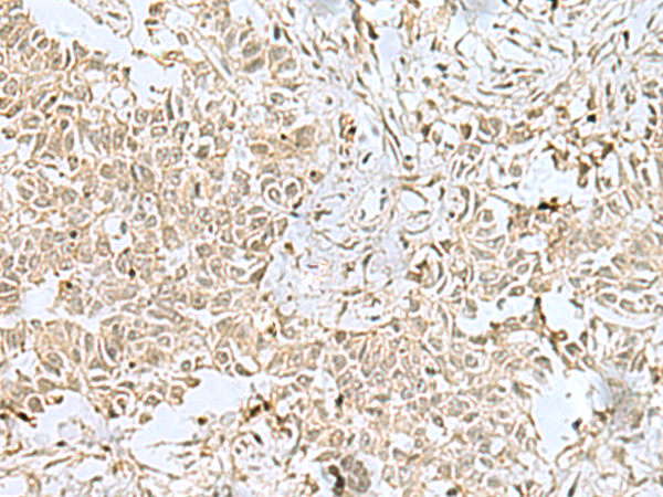 Rabbit Polyclonal Antibody to PGR