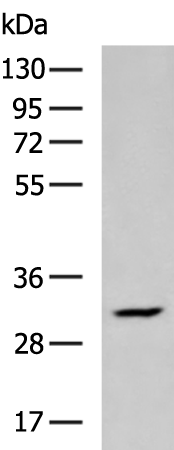 Rabbit Polyclonal Antibody to PSCA