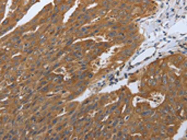 Rabbit Polyclonal Antibody to DLG4
