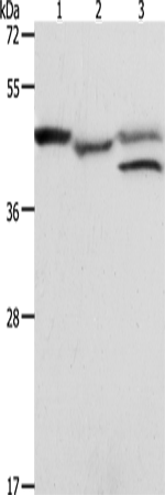 Rabbit Polyclonal Antibody to PSMD6