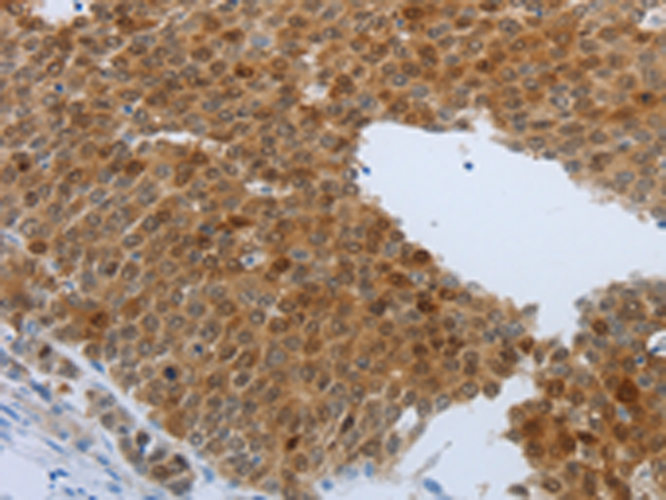 Rabbit Polyclonal Antibody to PTPRJ