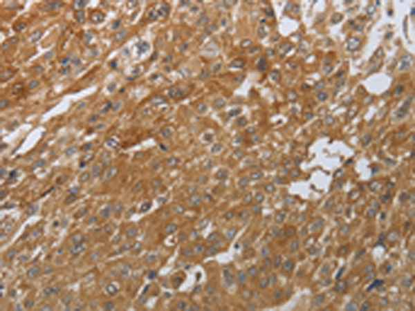 Rabbit Polyclonal Antibody to PTPRM