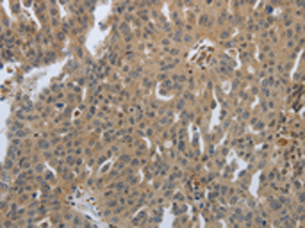 Rabbit Polyclonal Antibody to PTPRT