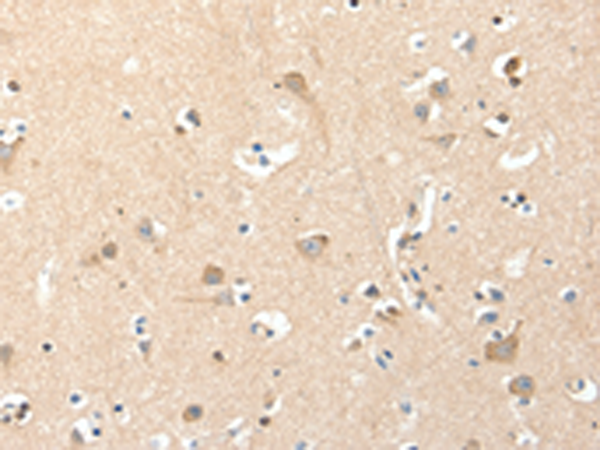 Rabbit Polyclonal Antibody to RRAD