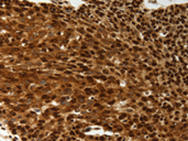 Rabbit Polyclonal Antibody to SCN1A