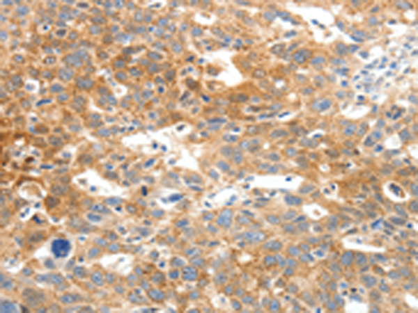 Rabbit Polyclonal Antibody to SCN5A