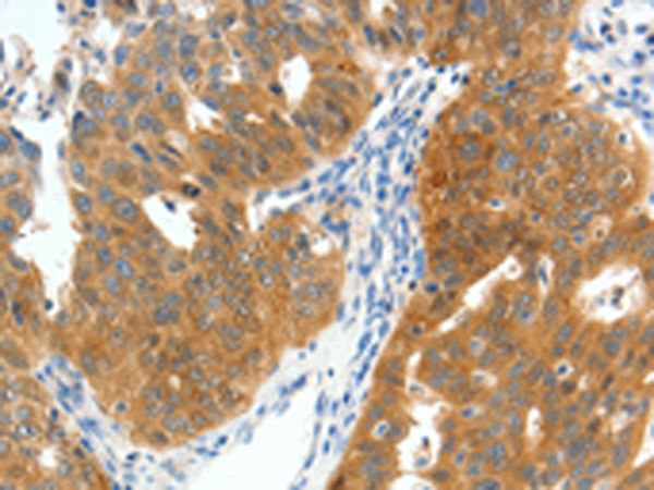 Rabbit Polyclonal Antibody to SCN9A