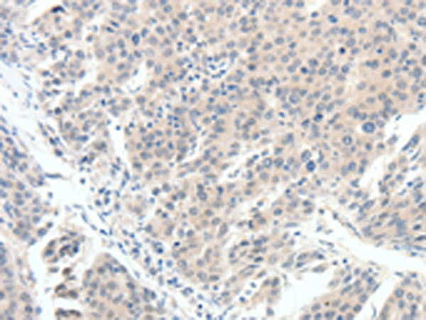 Rabbit Polyclonal Antibody to SCN10A