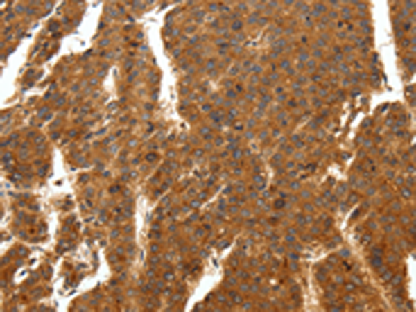 Rabbit Polyclonal Antibody to SCN11A