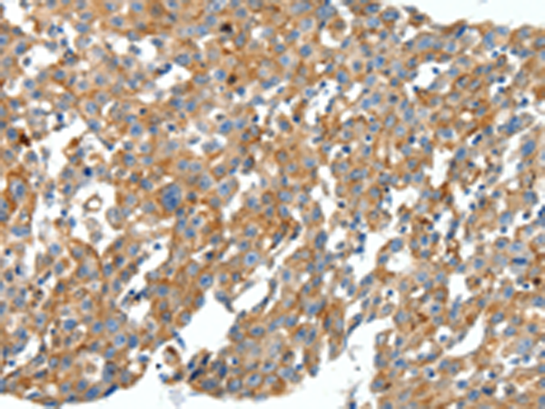 Rabbit Polyclonal Antibody to CXCL12