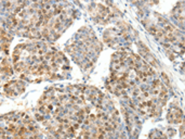 Rabbit Polyclonal Antibody to SCTR