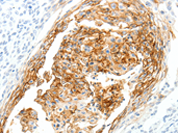 Rabbit Polyclonal Antibody to SEMA3D