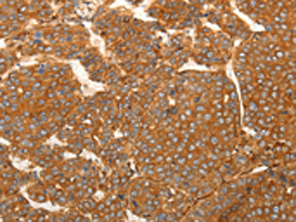 Rabbit Polyclonal Antibody to SFRP1