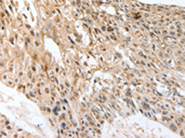 Rabbit Polyclonal Antibody to SLC1A7