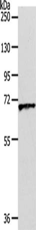 Rabbit Polyclonal Antibody to SLC22A3