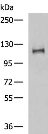 Rabbit Polyclonal Antibody to SLC24A1