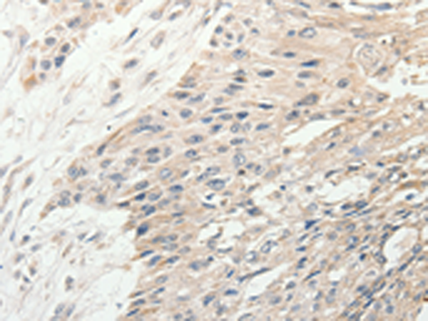 Rabbit Polyclonal Antibody to SLC9A7