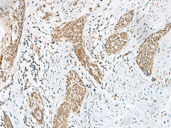 Rabbit Polyclonal Antibody to SOX8