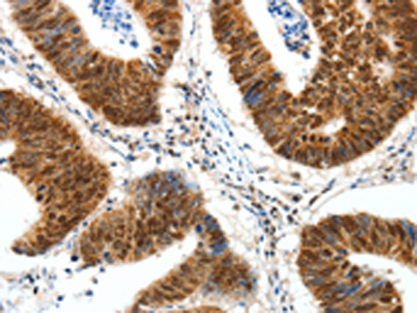Rabbit Polyclonal Antibody to SP1