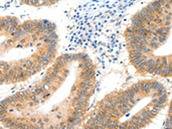 Rabbit Polyclonal Antibody to SIPA1