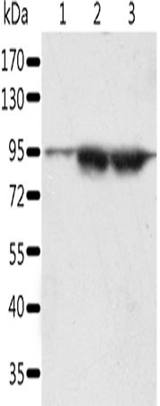 Rabbit Polyclonal Antibody to SPATA20