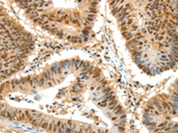 Rabbit Polyclonal Antibody to SSB