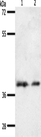 Rabbit Polyclonal Antibody to SSTR1
