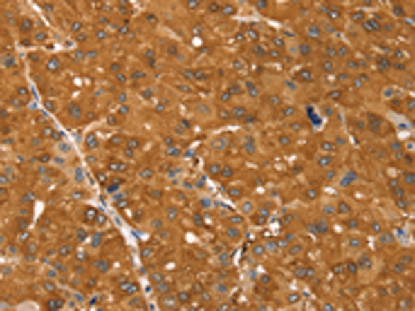 Rabbit Polyclonal Antibody to SSTR3