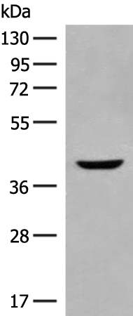Rabbit Polyclonal Antibody to SSTR5