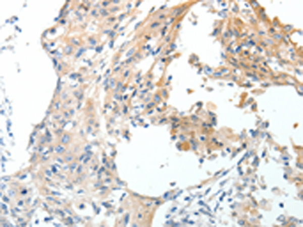 Rabbit Polyclonal Antibody to STEAP4