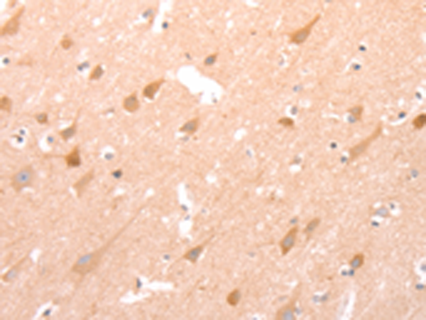 Rabbit Polyclonal Antibody to STRA8