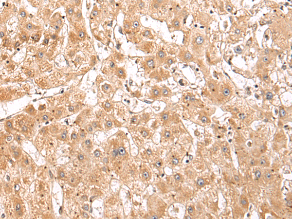 Rabbit Polyclonal Antibody to STRA6